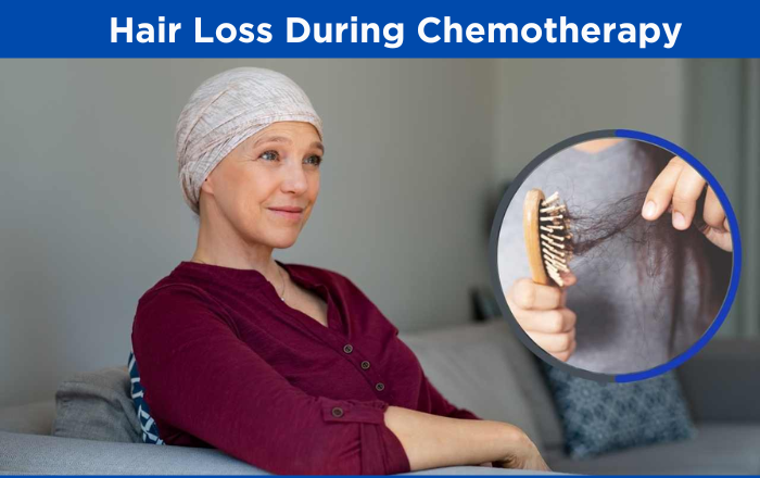 Understanding Hair Loss During Chemotherapy: