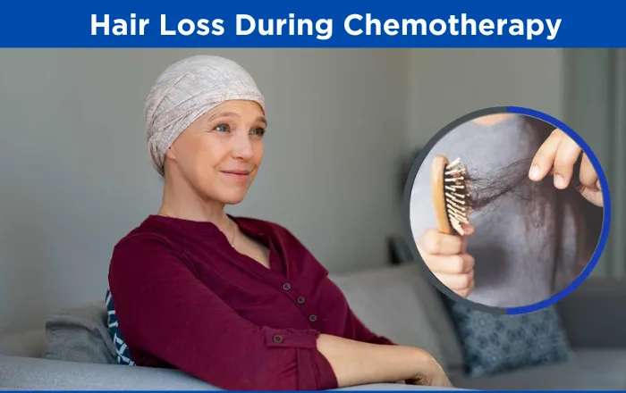 Understanding Hair Loss During Chemotherapy
