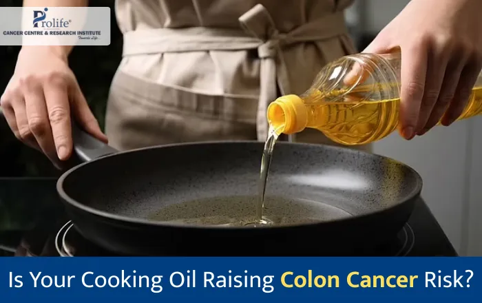 Common cooking oil could be causing colon cancer