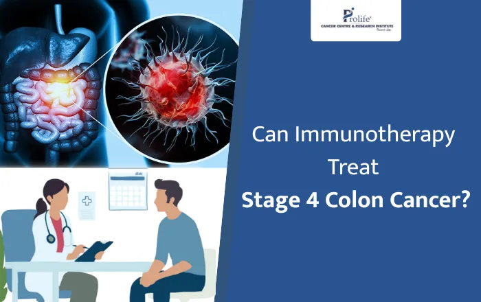 Can Immunotherapy Cure Stage 4 Colon Cancer 1