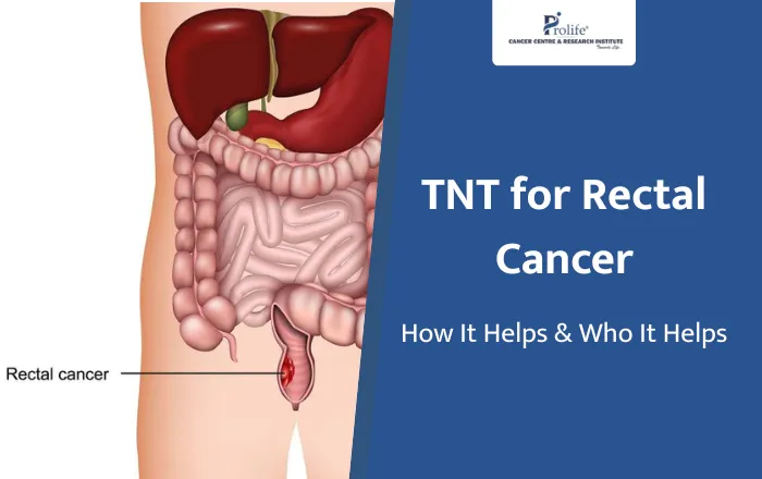 TNT for Rectal Cancer A Complete Guide to How It Works Who It Helps