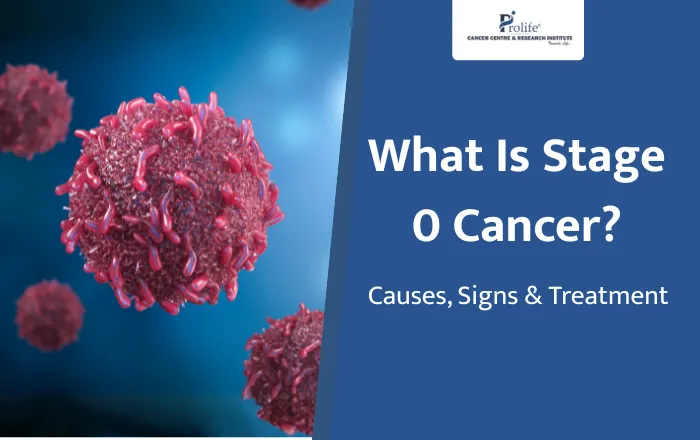 What Is Stage 0 Cancer Causes Early Signs and Treatment Explained