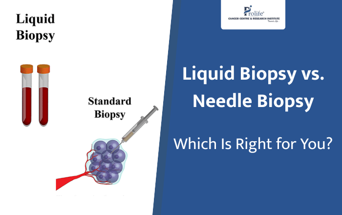 Liquid Biopsy vs. Needle Biopsy: Which Is Right for You?