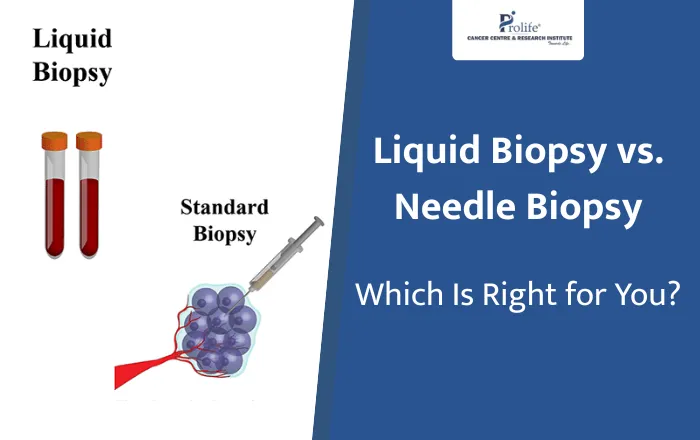 Liquid Biopsy vs. Needle Biopsy Which Is Right for You