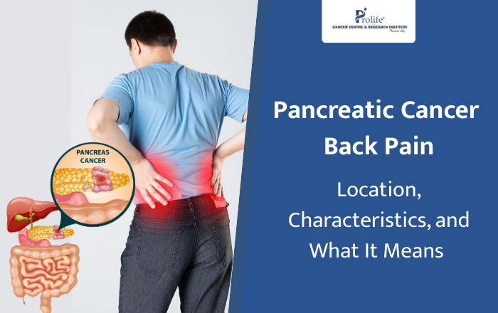 Pancreatic Cancer Back Pain: Location, Characteristics, and What It Means