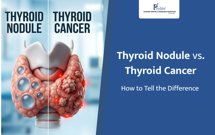 Thyroid Nodule vs. Thyroid Cancer: How to Tell the Difference