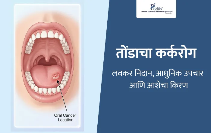 लवकर निदान आधुनिक उपचार आणि आशेचा किरण
