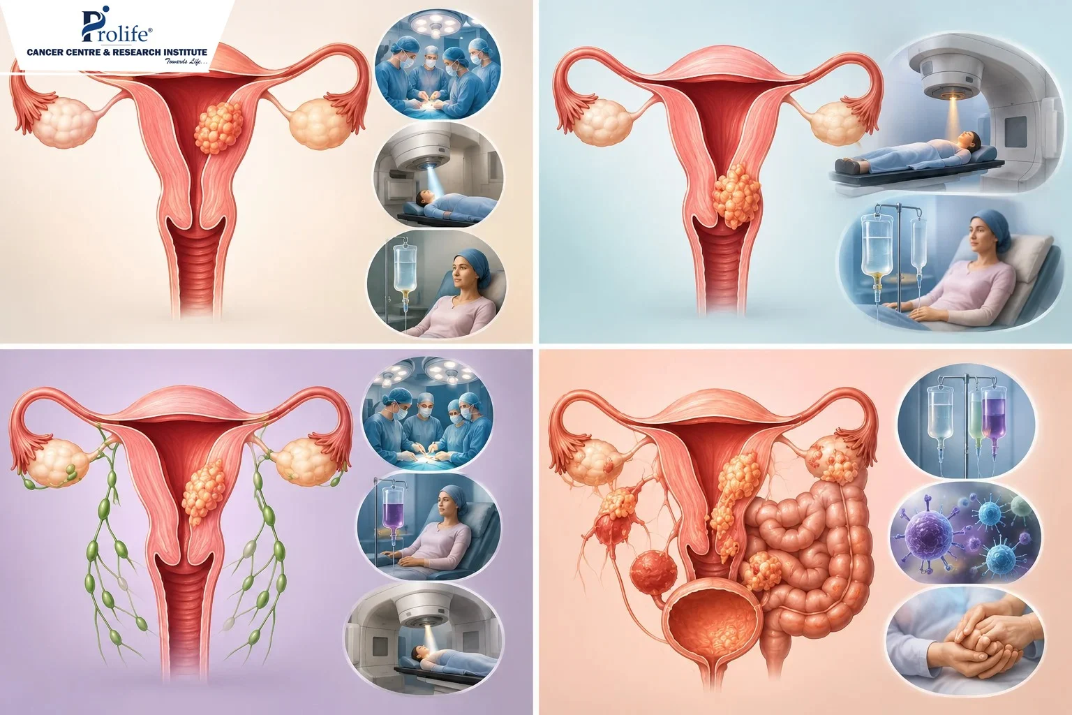 WhatsApp Image 2026-08-19 at 3.05.13 PM endometrial-cancer-causes-risk-factors-pune