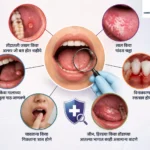 early-signs-of-mouth-cancer-symptoms-pune
