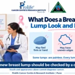 Prolife Pune infographic explaining possible breast cancer lump features and when to consult a doctor.