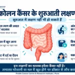 कोलन कैंसर के शुरुआती लक्षण—मल में खून, कब्ज या दस्त, पेट दर्द, वजन घटना और थकान का हिंदी इन्फोग्राफिक।