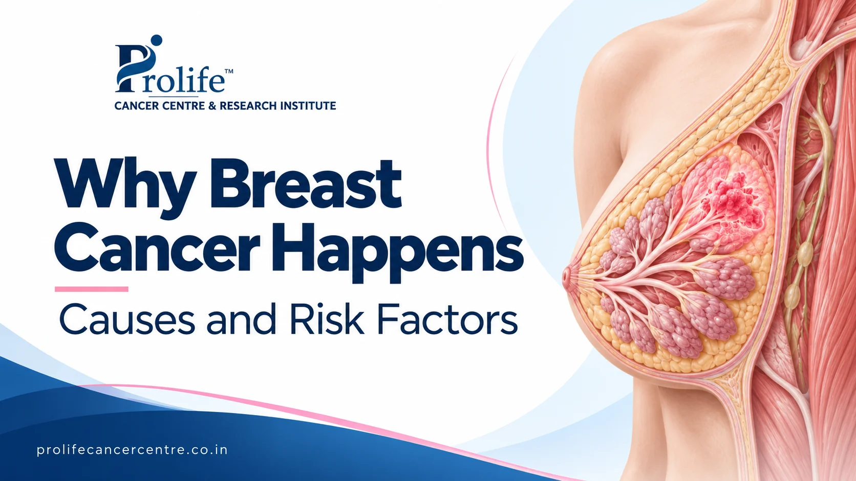 why-breast-cancer-happens